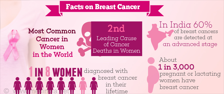 Breast-cancer-treatment-Dr-Santhosh-Selvam